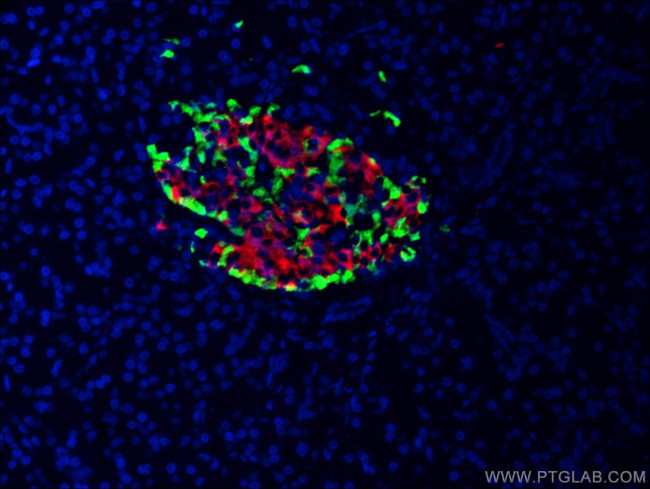 Glucagon Antibody in Immunocytochemistry (ICC/IF)