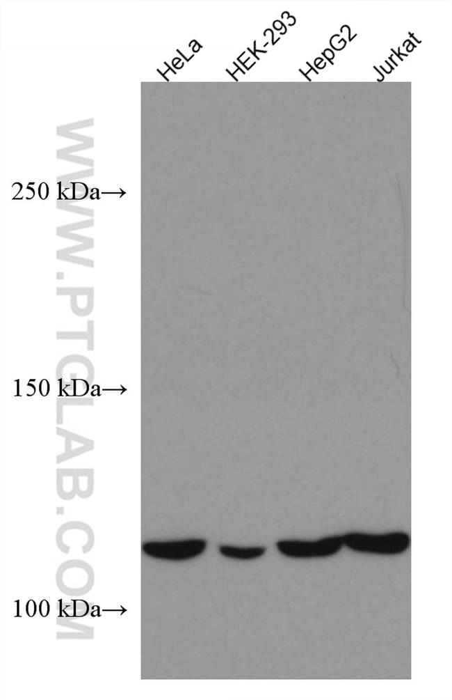 DAAM1 Antibody in Western Blot (WB)