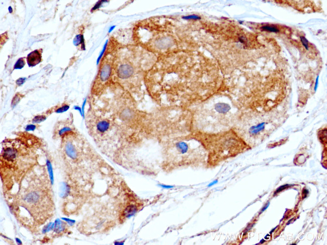 PRLR Antibody in Immunohistochemistry (Paraffin) (IHC (P))