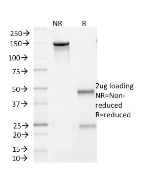 BRAF (V600E Mutant Specific) (Prognostic Marker) Antibody in SDS-PAGE (SDS-PAGE)