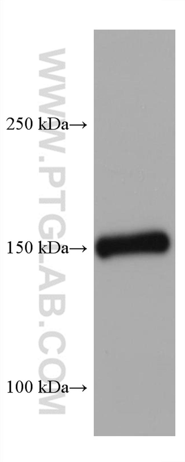 Entactin Antibody in Western Blot (WB)