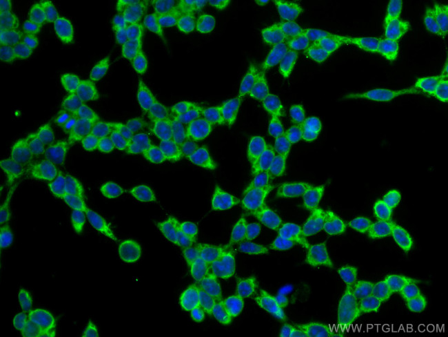 TRIM25 Antibody in Immunocytochemistry (ICC/IF)