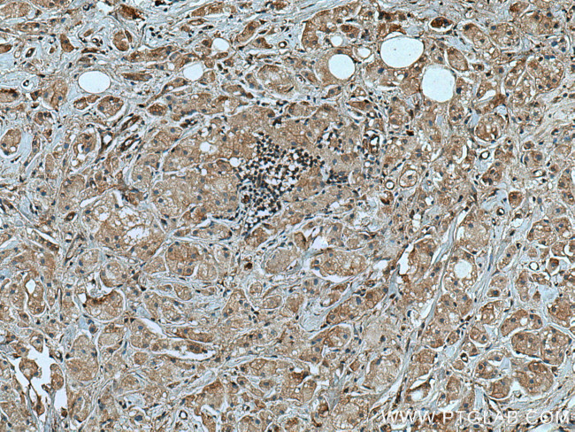 TRIM25 Antibody in Immunohistochemistry (Paraffin) (IHC (P))