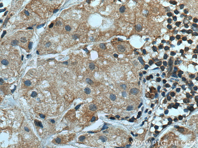 TRIM25 Antibody in Immunohistochemistry (Paraffin) (IHC (P))