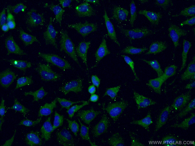 TRAF2 Antibody in Immunocytochemistry (ICC/IF)