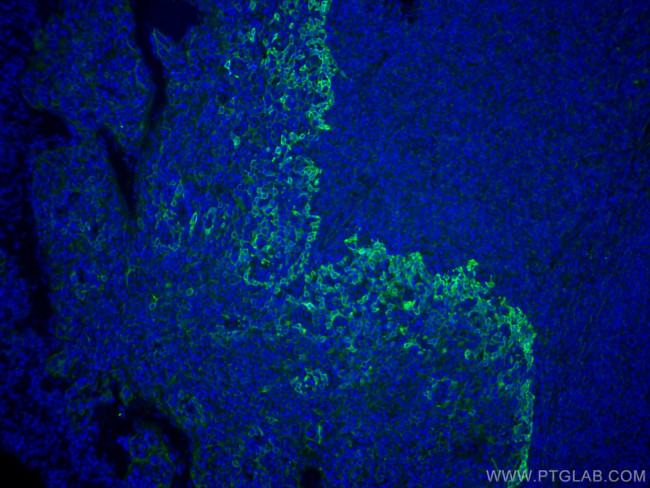 TLR8 Antibody in Immunohistochemistry (Paraffin) (IHC (P))