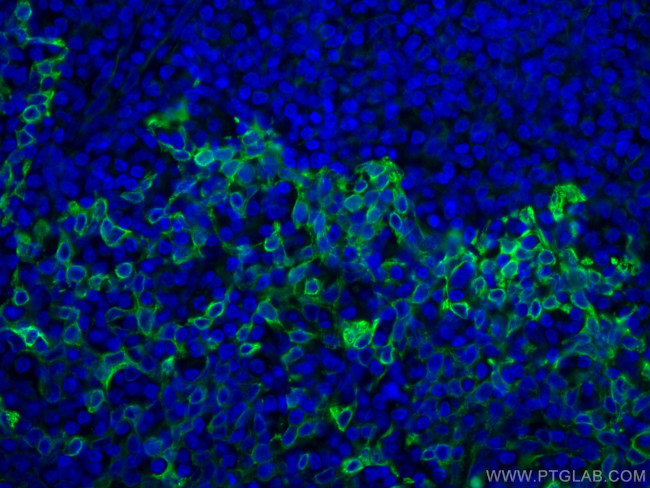 TLR8 Antibody in Immunohistochemistry (Paraffin) (IHC (P))