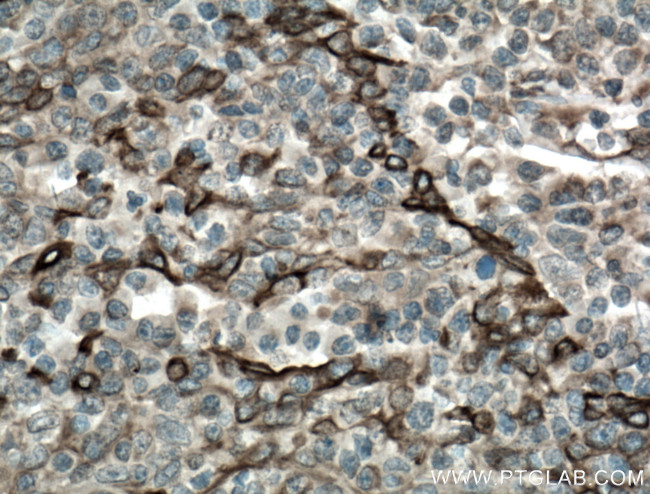 TLR8 Antibody in Immunohistochemistry (Paraffin) (IHC (P))