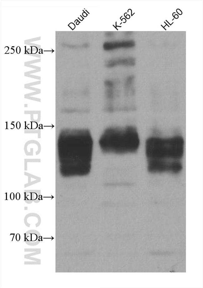 TLR8 Antibody in Western Blot (WB)