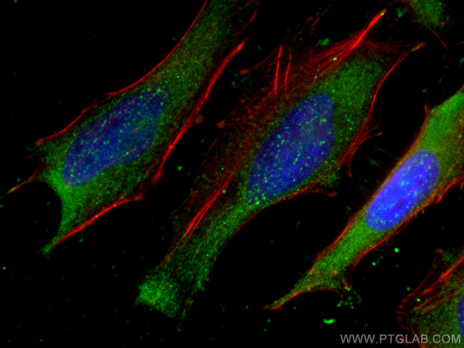 USP8 Antibody in Immunocytochemistry (ICC/IF)