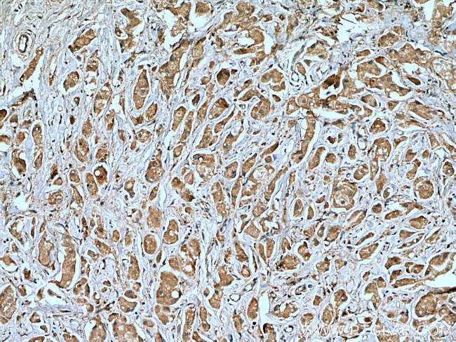 USP8 Antibody in Immunohistochemistry (Paraffin) (IHC (P))