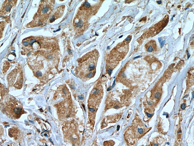 USP8 Antibody in Immunohistochemistry (Paraffin) (IHC (P))