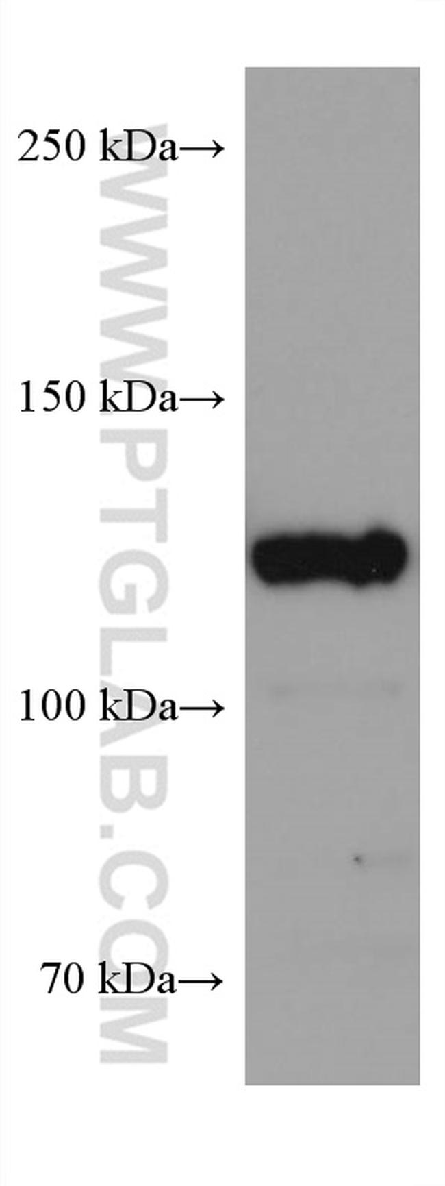 USP8 Antibody in Western Blot (WB)