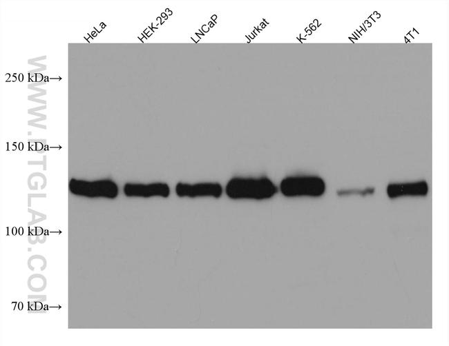 USP8 Antibody in Western Blot (WB)