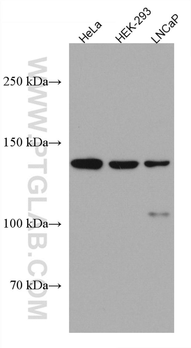 WDR19 Antibody in Western Blot (WB)