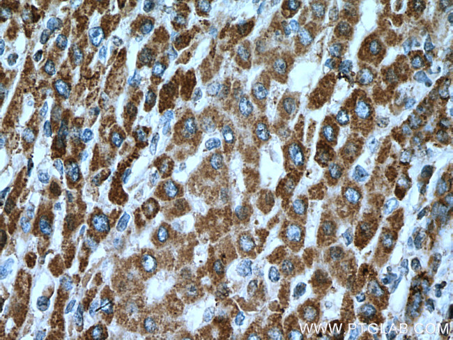 ACSM5 Antibody in Immunohistochemistry (Paraffin) (IHC (P))