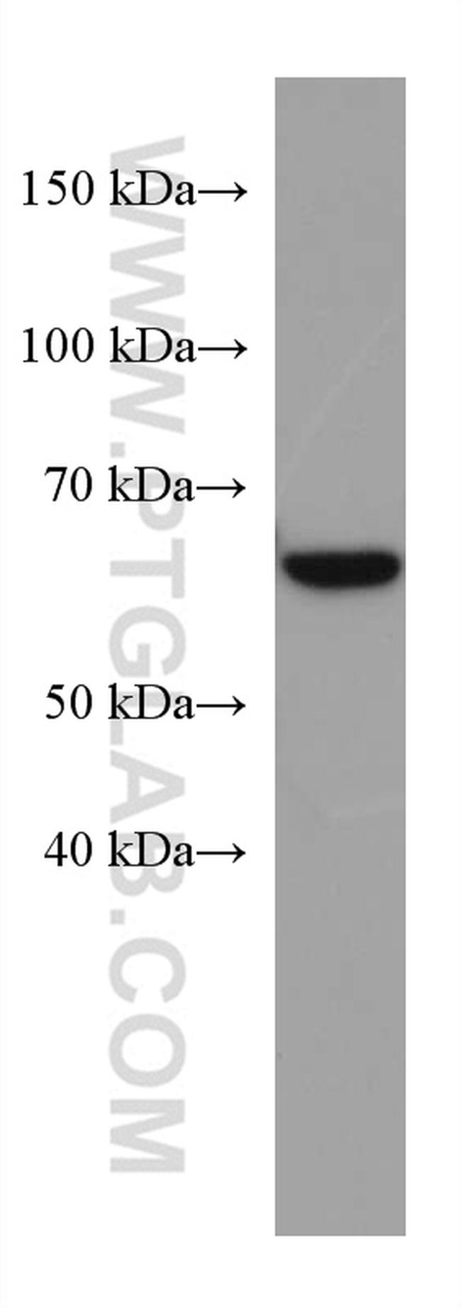 ACSM5 Antibody in Western Blot (WB)