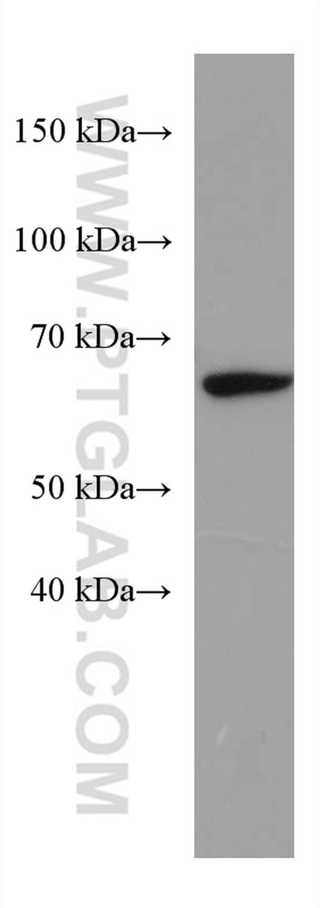 ACSM5 Antibody in Western Blot (WB)