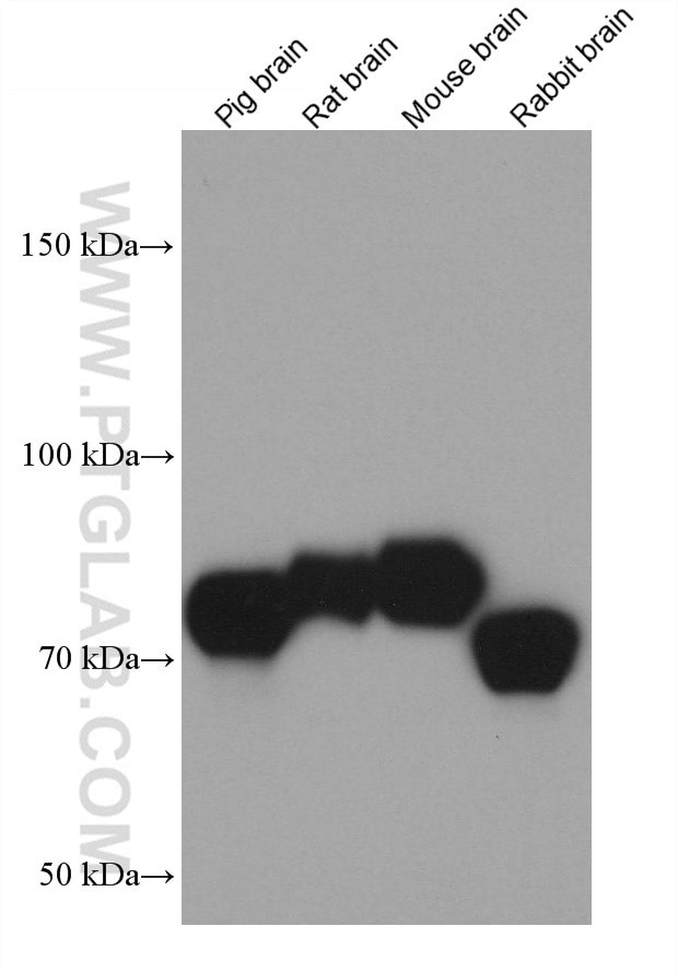 SIRP Alpha Antibody in Western Blot (WB)