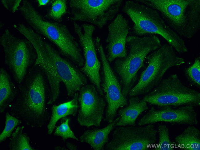 PSMD9 Antibody in Immunocytochemistry (ICC/IF)