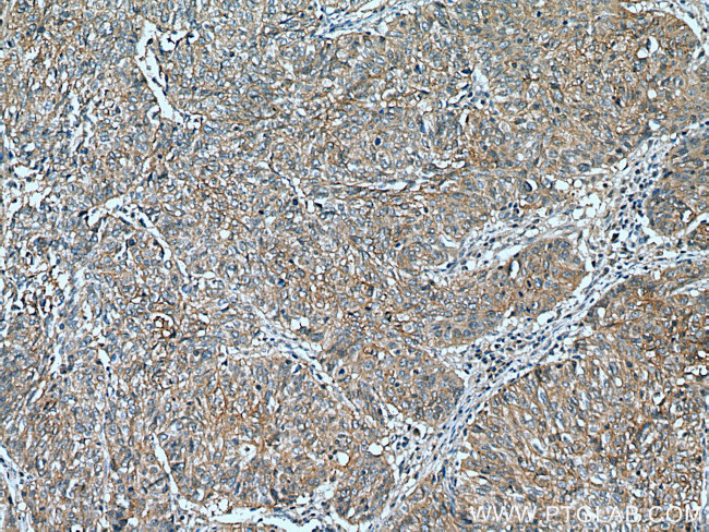 PSMD9 Antibody in Immunohistochemistry (Paraffin) (IHC (P))