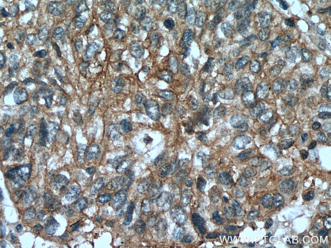 PSMD9 Antibody in Immunohistochemistry (Paraffin) (IHC (P))