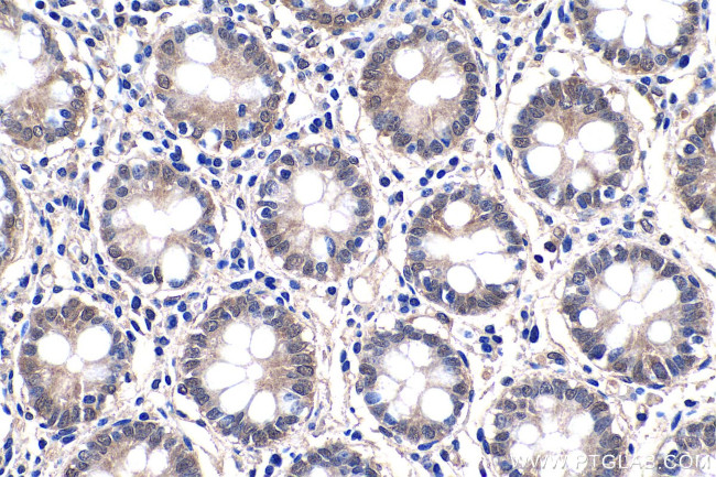 SMAD2 Antibody in Immunohistochemistry (Paraffin) (IHC (P))