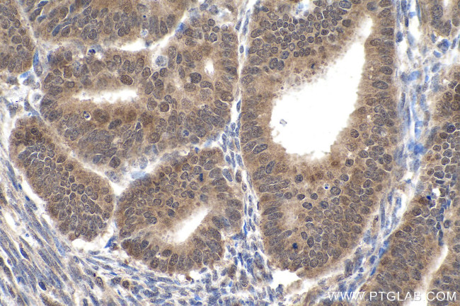 SMAD2 Antibody in Immunohistochemistry (Paraffin) (IHC (P))