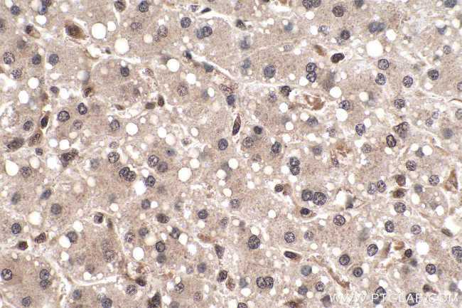 SMAD2 Antibody in Immunohistochemistry (Paraffin) (IHC (P))