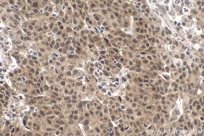 SMAD2 Antibody in Immunohistochemistry (Paraffin) (IHC (P))