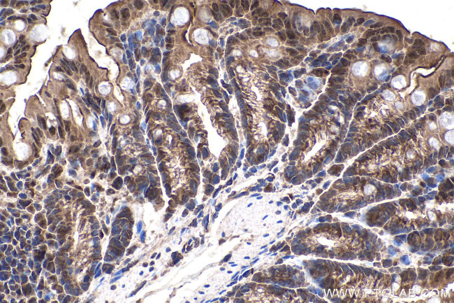 SMAD2 Antibody in Immunohistochemistry (Paraffin) (IHC (P))