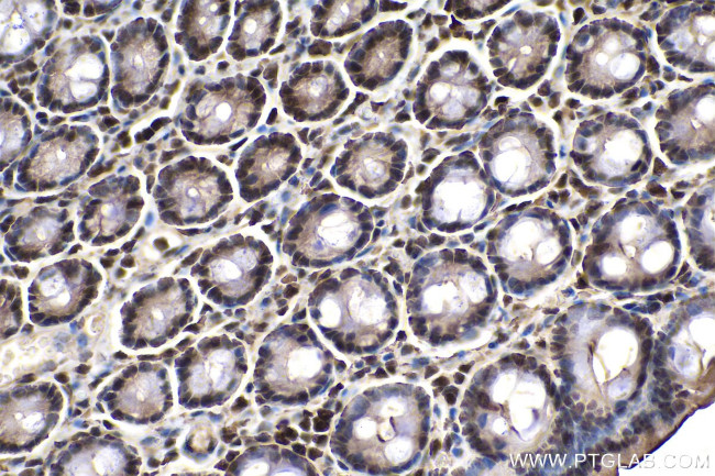 SMAD2 Antibody in Immunohistochemistry (Paraffin) (IHC (P))