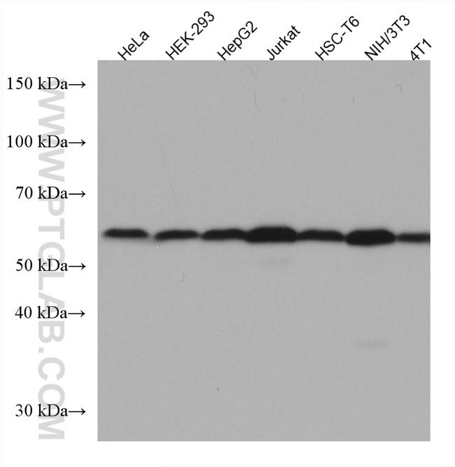 SMAD2 Antibody in Western Blot (WB)