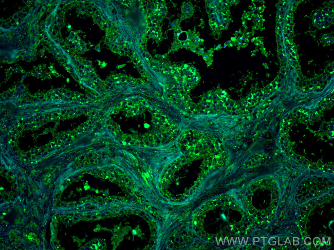 FUT3 Antibody in Immunohistochemistry (Paraffin) (IHC (P))