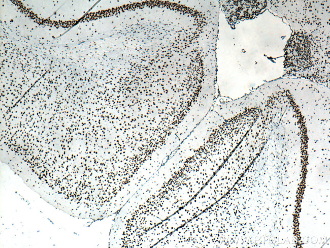 TDP-43 Antibody in Immunohistochemistry (Paraffin) (IHC (P))