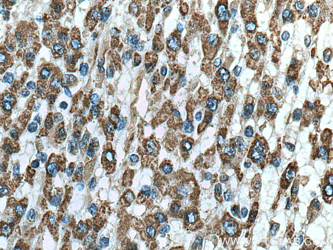 ALDH5A1 Antibody in Immunohistochemistry (Paraffin) (IHC (P))