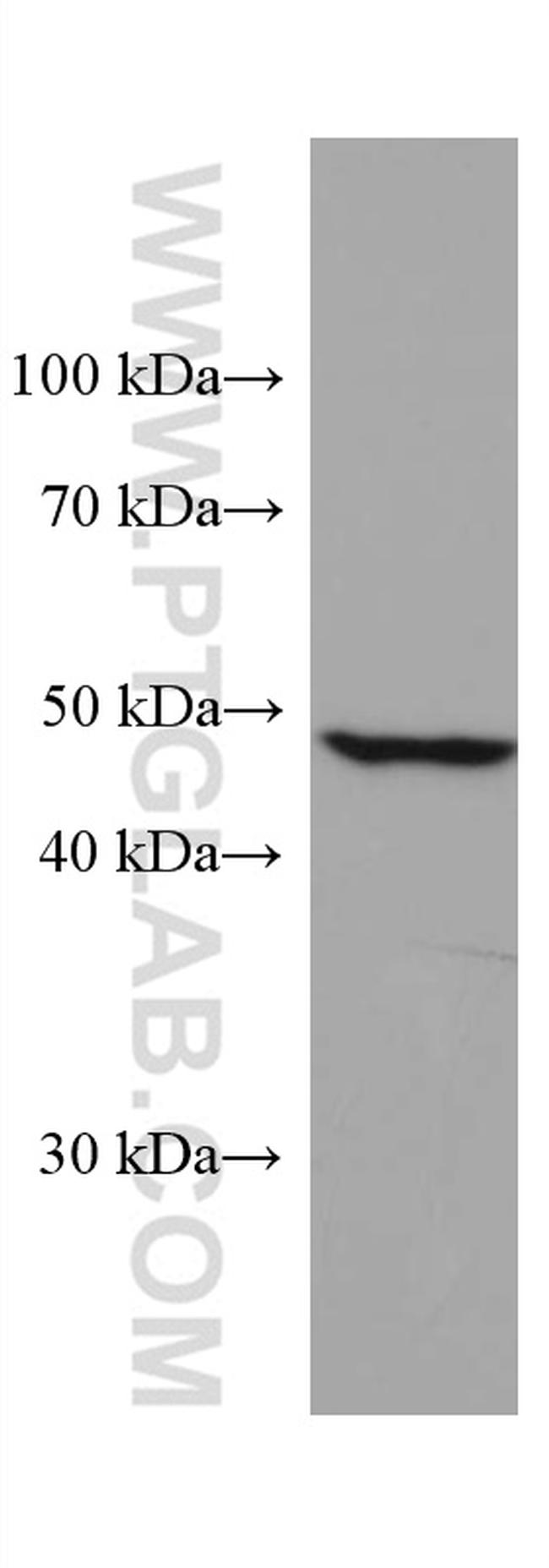 ALDH5A1 Antibody in Western Blot (WB)