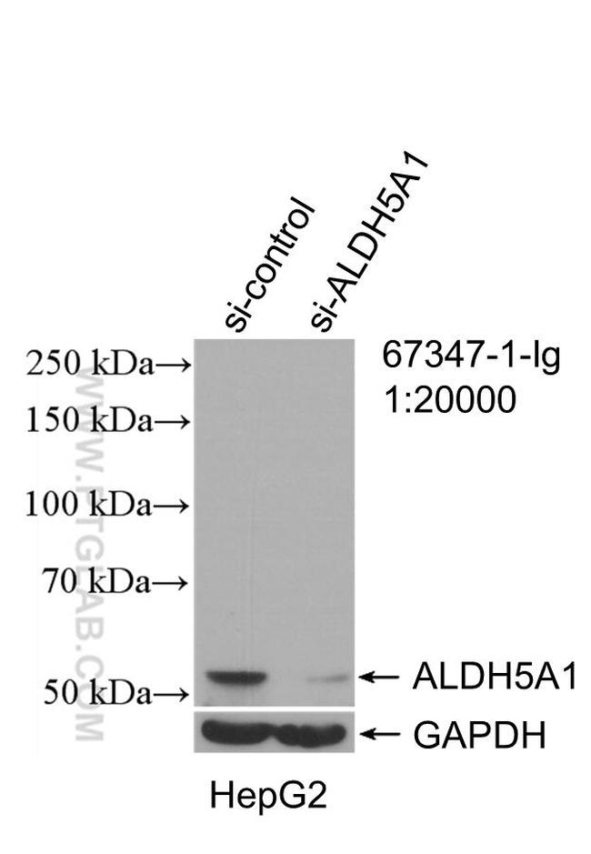 ALDH5A1 Antibody in Western Blot (WB)