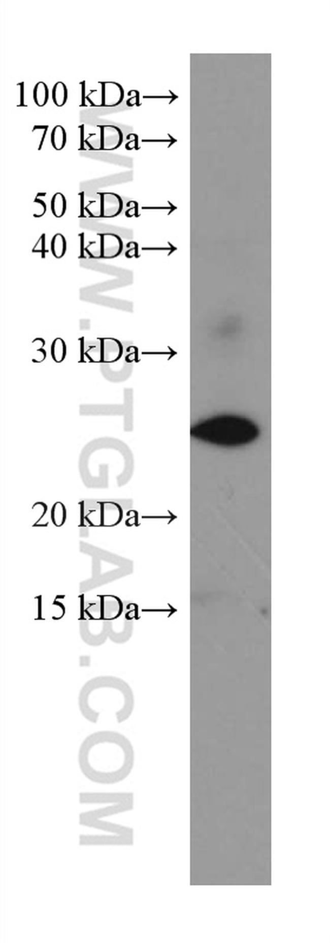 SRY Antibody in Western Blot (WB)