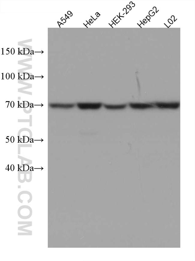 MUS81 Antibody in Western Blot (WB)