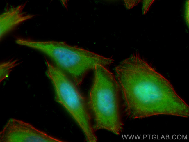 UGDH Antibody in Immunocytochemistry (ICC/IF)