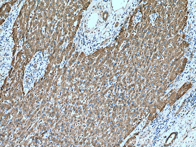 UGDH Antibody in Immunohistochemistry (Paraffin) (IHC (P))