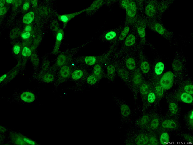 p21 Antibody in Immunocytochemistry (ICC/IF)