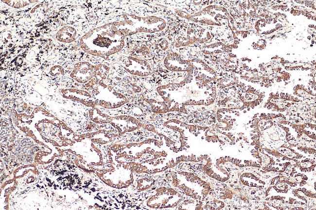 TBXAS1 Antibody in Immunohistochemistry (Paraffin) (IHC (P))