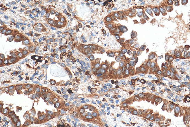 TBXAS1 Antibody in Immunohistochemistry (Paraffin) (IHC (P))