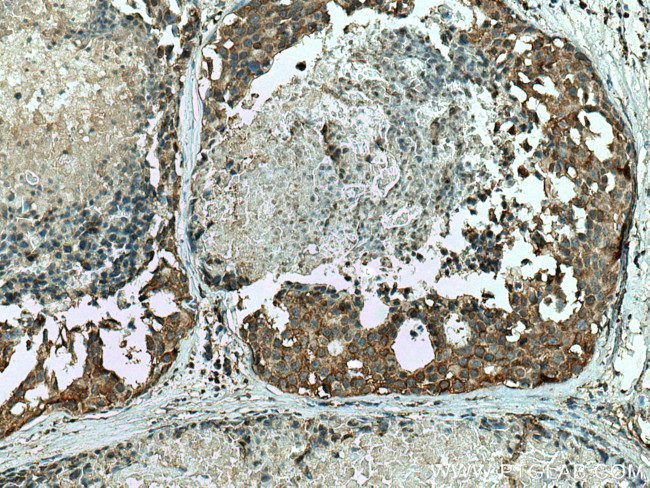 ALDH9A1 Antibody in Immunohistochemistry (Paraffin) (IHC (P))