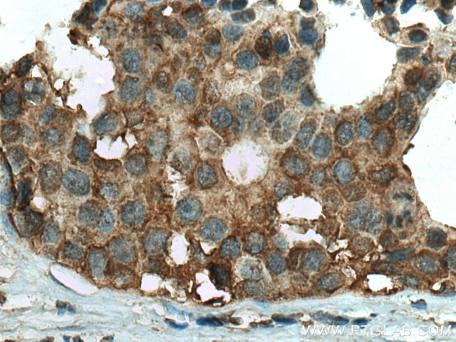 ALDH9A1 Antibody in Immunohistochemistry (Paraffin) (IHC (P))