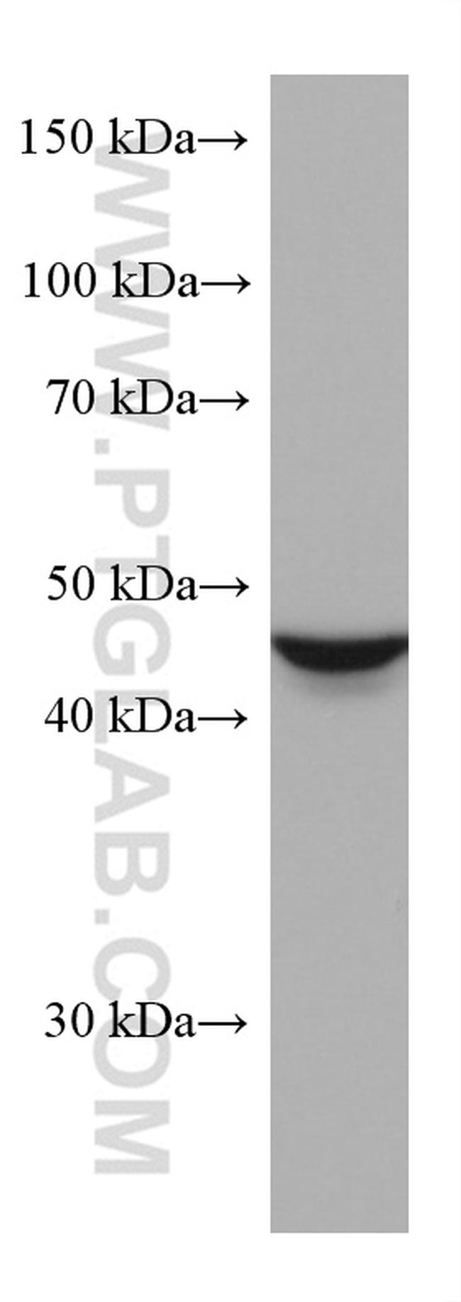 ALDH9A1 Antibody in Western Blot (WB)