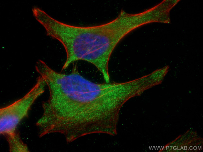 ACC Antibody in Immunocytochemistry (ICC/IF)