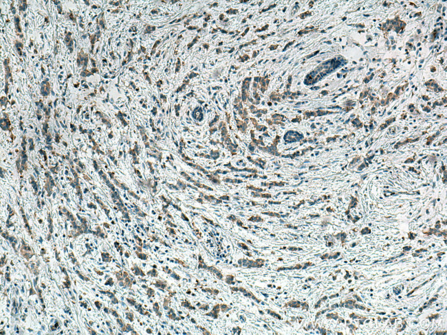 ACC Antibody in Immunohistochemistry (Paraffin) (IHC (P))